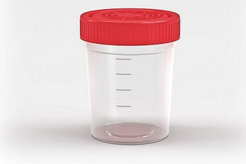 container for checking for parasites