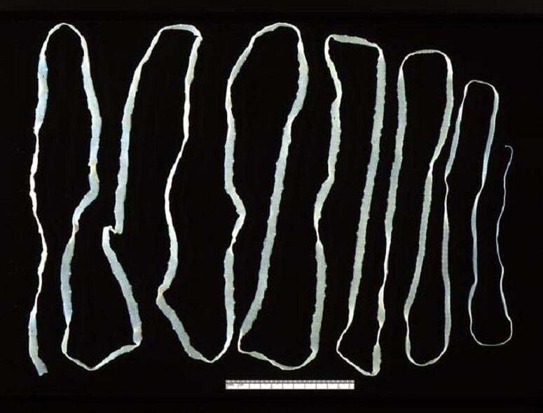 Tapeworm removed from the human intestine