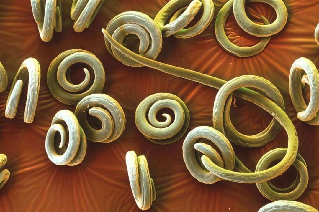 worm parasites from the human body