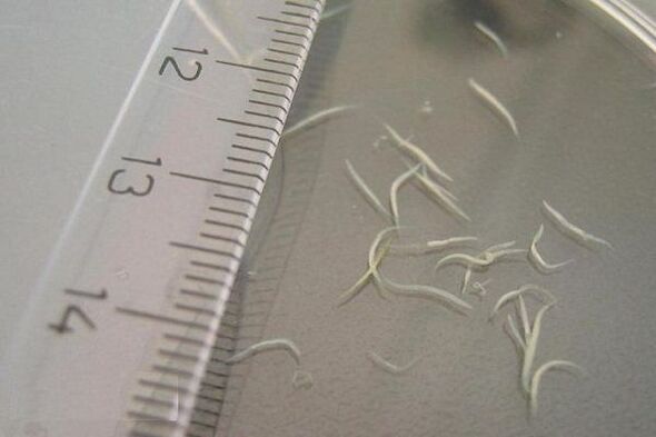 What do pinworms look like 
