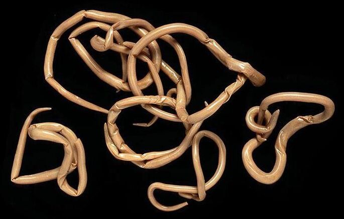 roundworms in the body