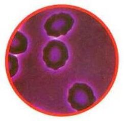 The stress of red blood cells