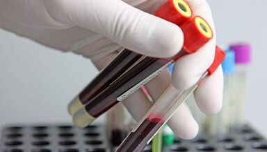 How can the tests take tests for parasites in the body
