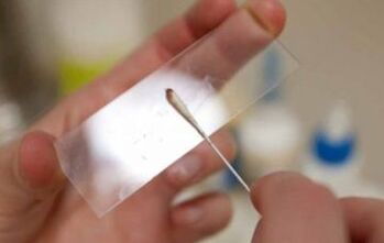 What tests should be taken for parasites
