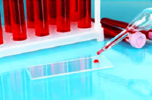 Blood inspection