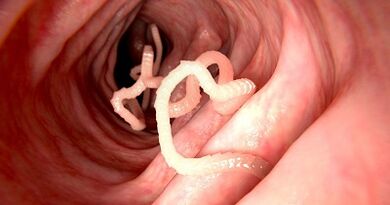 Reasons for parasites in the human body