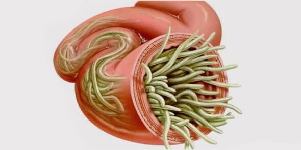 Parasites in the human intestine