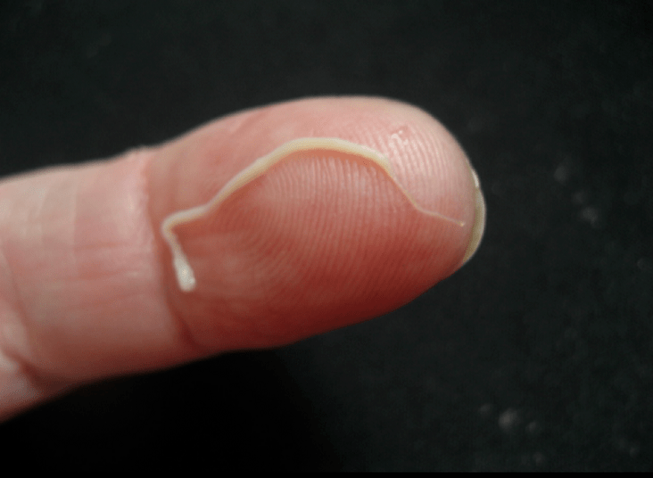 A roundworm parasite from the human body